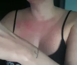 Potorras